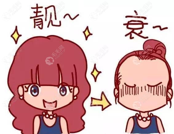 种植发际线的漫画图