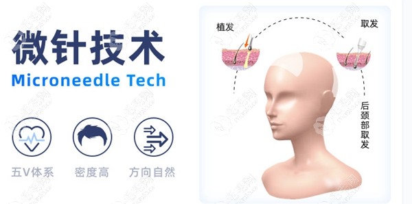 碧莲盛各种植技术优势