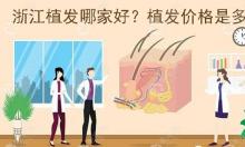 【攻略】浙江省正规植发医院哪家好?做毛发移植怎么收费?