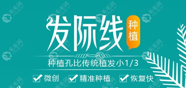 广州青逸做精密无痕植发际线1000个单位多少钱?新费用表来喽