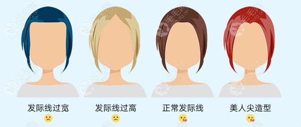 发际线种植的适应范围