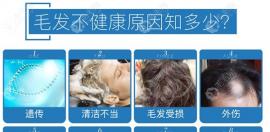 苏州植发哪家医院比较好?看脱发好的医院建议参考这几家!