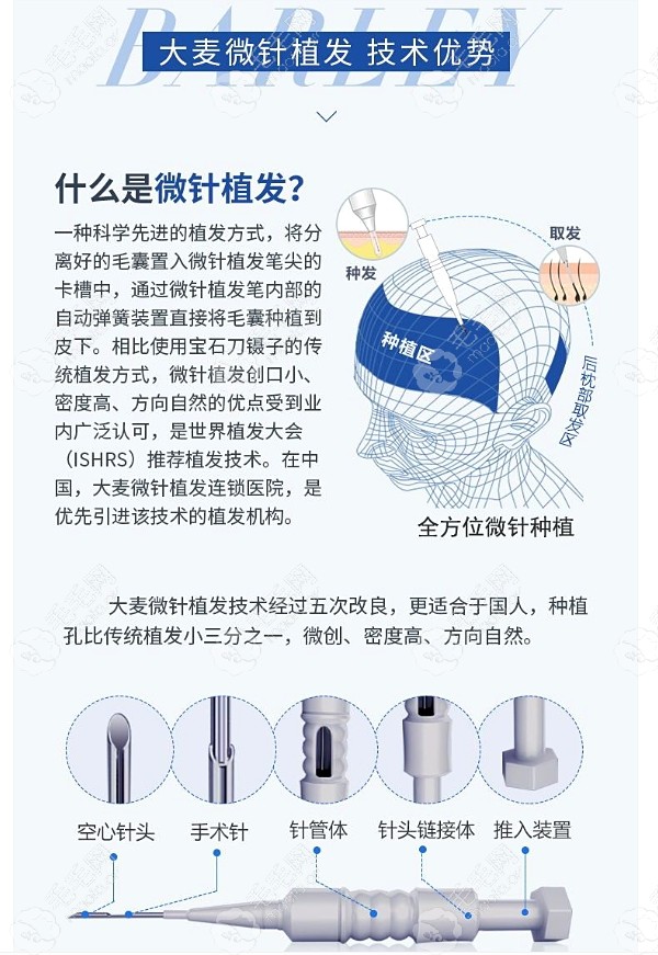 武汉分院大麦微针的植发技术是什么