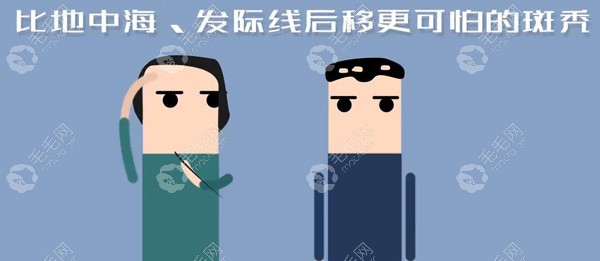 斑秃怎么治疗?分享镇江新生斑秃再生理疗的优势及治疗效果