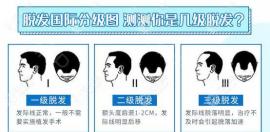 22岁男孩额角发际线后移两厘米算几级脱发？还能长回来吗？