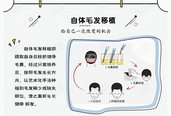 惠州市中信医院植发怎么样