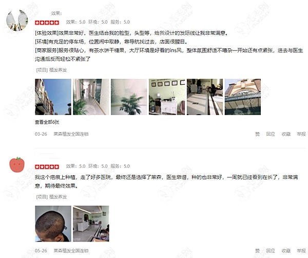 嘉兴莱森植发医院口碑比较好