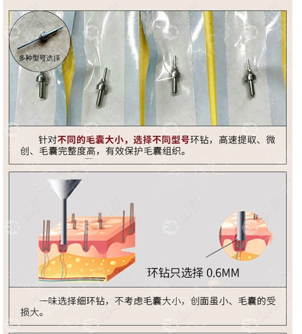 重庆艺星植发技术和效果怎么样？