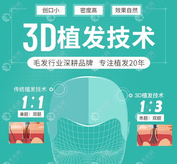 昆明新生3D植发技术优势