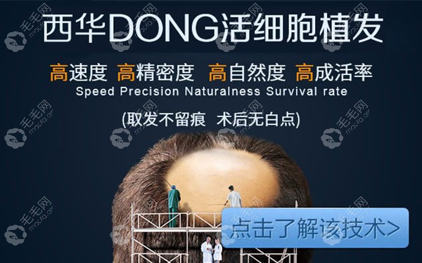 泉州西华根源DONG活细胞植发技术