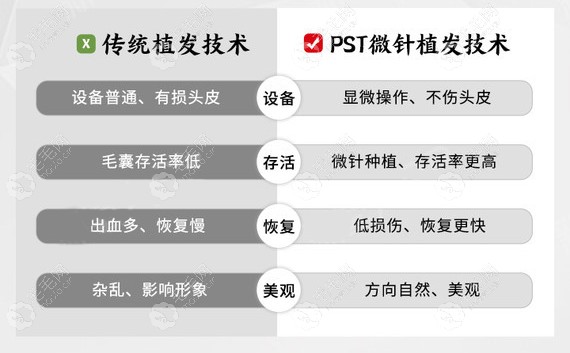 深圳鹏程医院PST微针植发技术优势