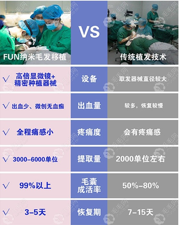 惠州时光植发优势特点