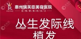 惠州哪里可以植發(fā)?惠州植發(fā)醫(yī)院排名前三榜速來get!