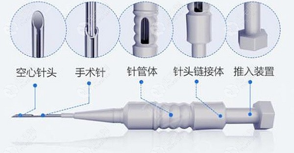 华美先进的微针植发技术