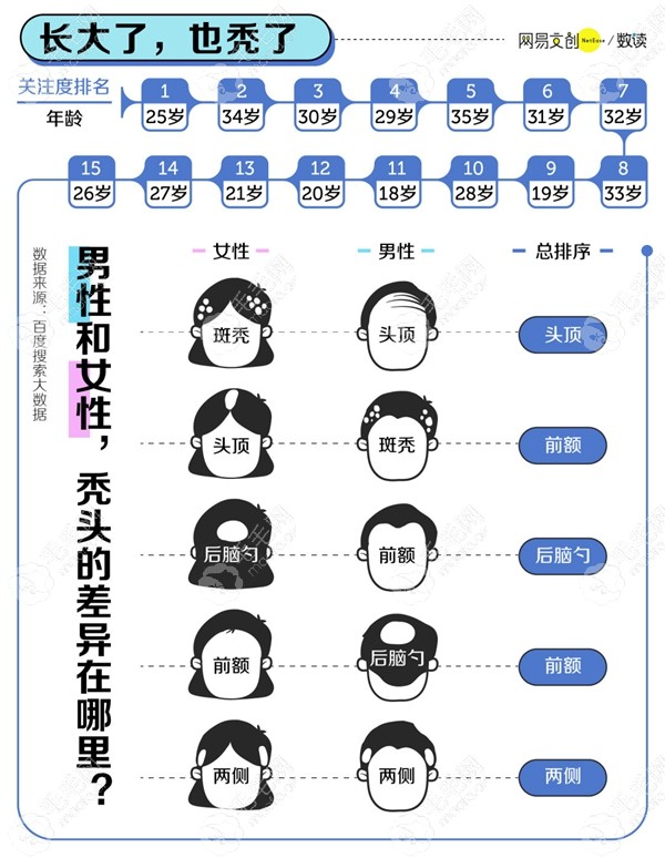 国内脱发人群比例