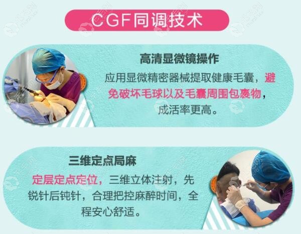 成都恒博医院植发技术怎么样?CGF种头发技术的成活率比较高