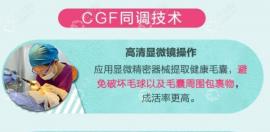 成都恒博医院植发技术怎么样?CGF种头发技术的成活率比较高