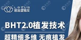 郑州碧莲盛种植单侧眉毛多少钱?利用了BHT2.0技术价格9600元起