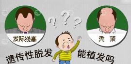 蚌埠哪家正规植发医院比较好啊?我是遗传性脱发想种头发