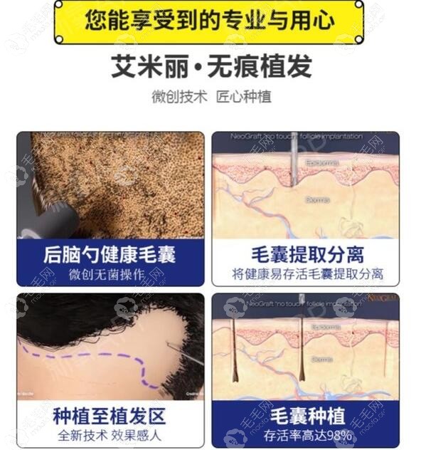 成都艾米丽医院的植发科简介