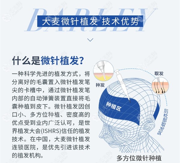 大麦微针植发的PSE种发技术怎么样?据说术后无血痂费用不高