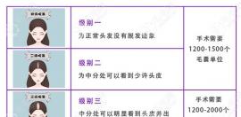 今日提问:一般植发要植多少个毛囊,种一个毛囊需要多少钱?