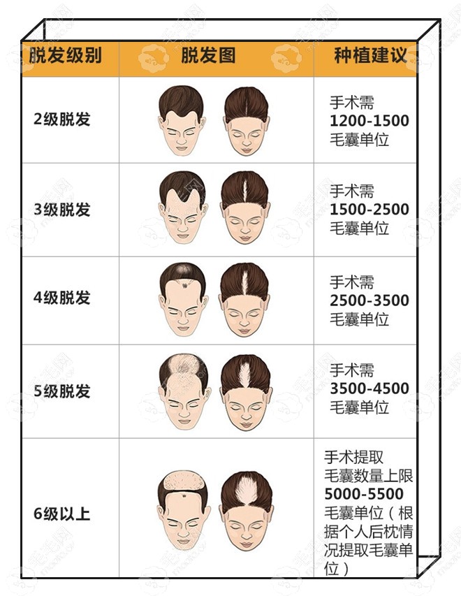 广州壹加壹植发多少钱?点评这家医院的植发费用很是亲民呐!