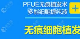 PFUE无痕细胞植发技术的特点及优势体现在这些真实案例里了