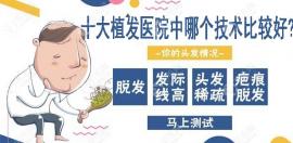 中国公认好的十大植发医院中哪个技术比较好?