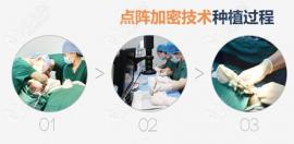 点阵加密和微针植发的区别原来在这!我先下看价格差多少钱
