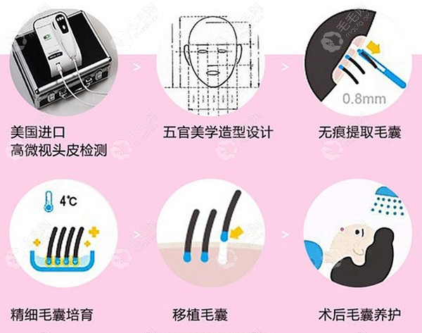美丽焦点植发优势