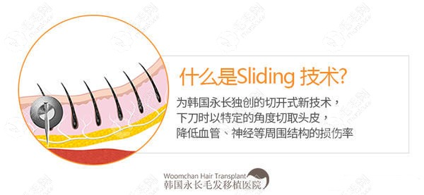 独特的Sliding 技术减少皮肤创伤