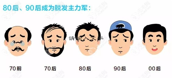 长沙植发价格多少钱？以植发1个毛囊单位的价格来说