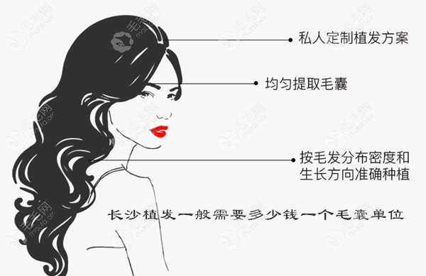 长沙植发一般多少钱1个毛囊单位?从正规技术好的植发医院说