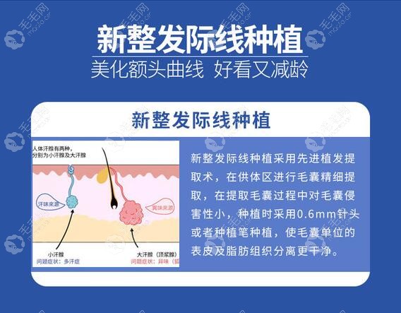 乌鲁木齐市正规植发医院排名