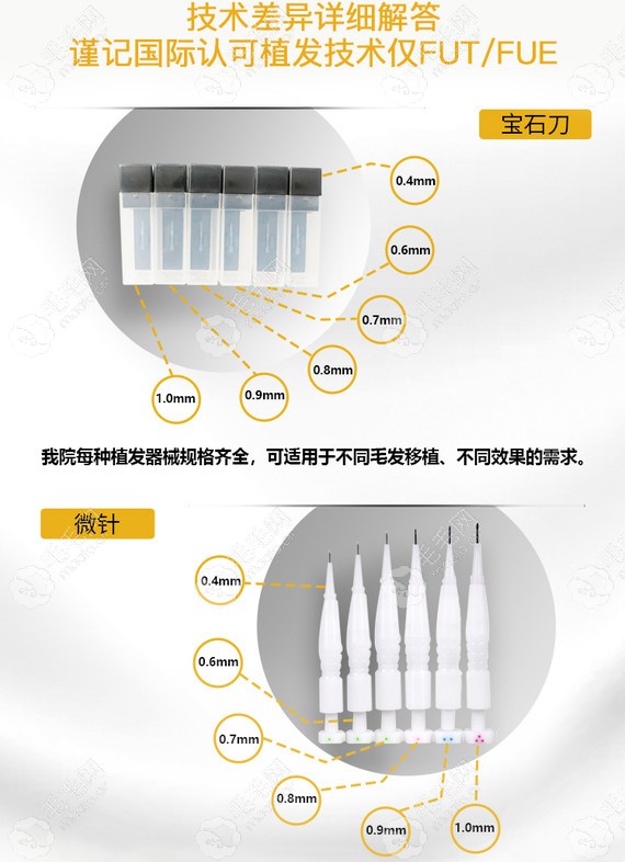 成都恒美植发技术过硬