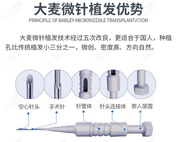 重庆大麦微针植发主要有7种植发技术