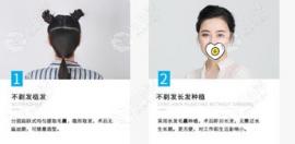 成都首瑞毛发移植诊所用的是什么植发技术?效果怎么样呢？
