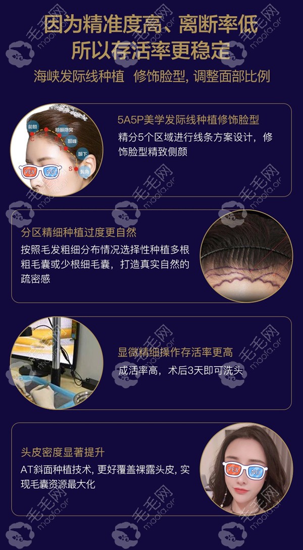 福州海峡发际线种植优势