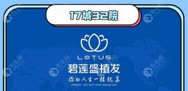 连环扣:现在哪个机构的植发技术好一点?用的是目前特先进的