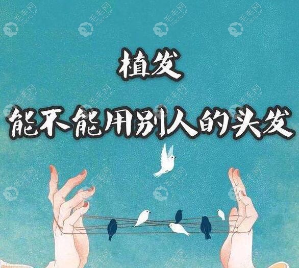 我头发特少想问:植发可以移植亲人的毛囊吗?有什么副作用吗