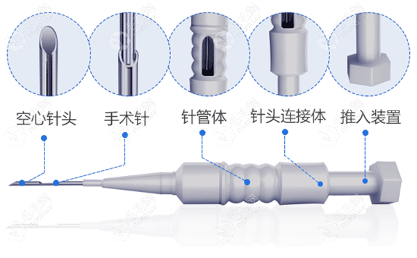 传统微针种植技术