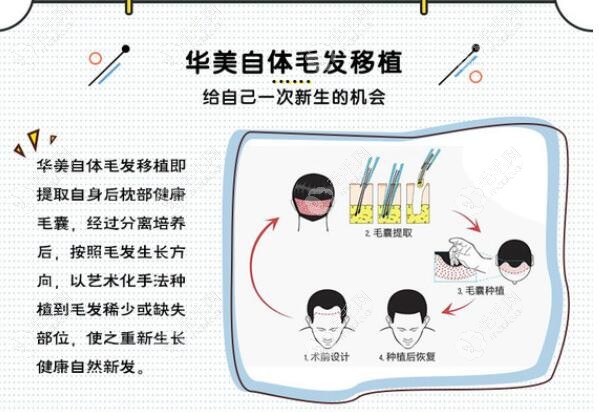 海南华美FUE植发技术的优势