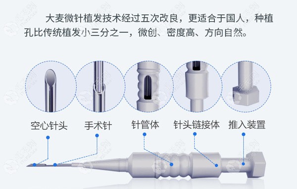 郑州大麦微针植发技术