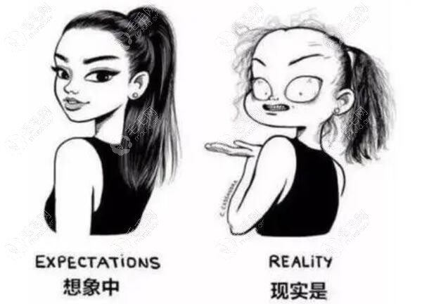 意大利纤维植发的危害