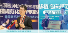 广西比较好的正规医院植发一次多少钱?想了解植发际线费用