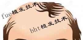 金华毛发种植的收费价格表来了,附上植发的地址~