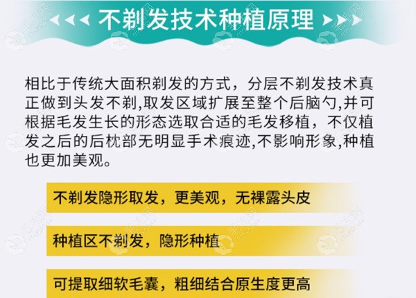 郑州芳艺不剃发植发技术优势