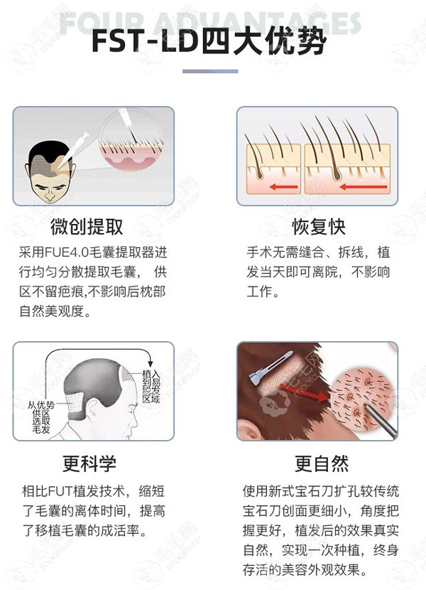 昆明青青FST植发优势