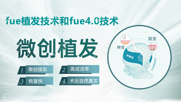 FUE技术和FUE4.0技术的不同